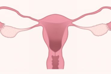 uterus, ovary, ovaries